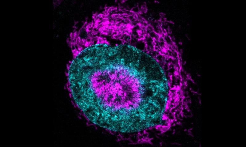 Cancer cells “power up” under pressure
