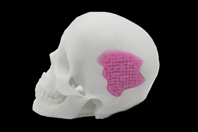 3D printing method