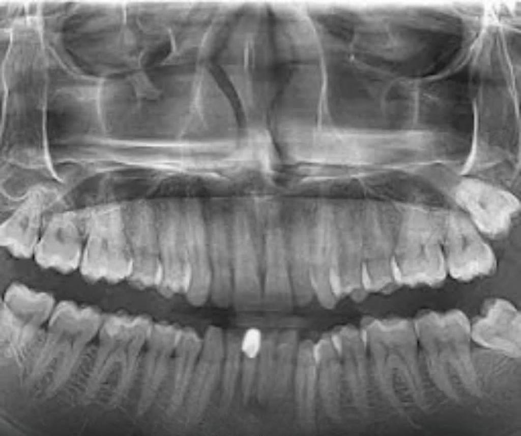 teeth